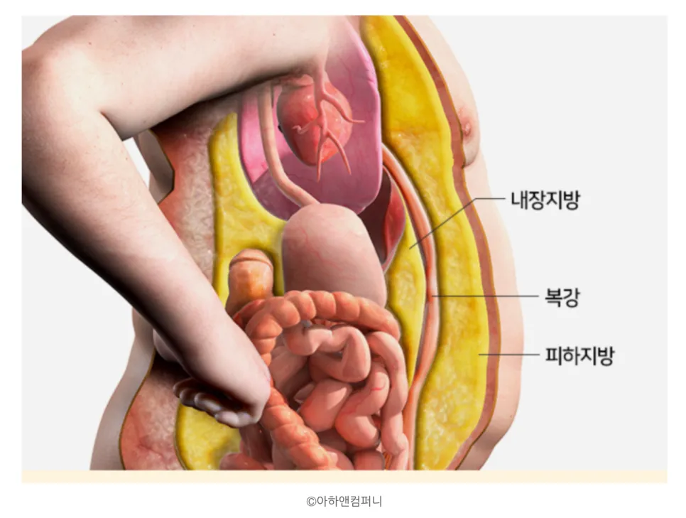 다이어트, 뱃살 안 빠지는 이유? 내장지방부터 보셔야 합니다