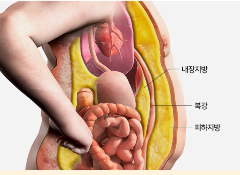 뱃살 빼는법? 내장지방 빼는법 부터 알아야 합니다.(군산 명작한의원)