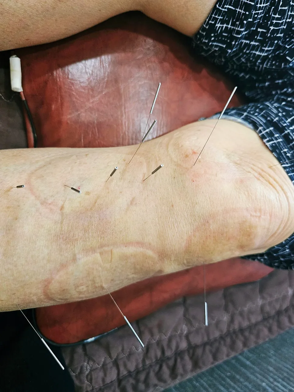 다이어트와 무릎관절염 이야기(명작한의원)