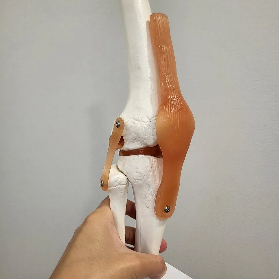 무릎 연골이 닳았어요. 무릎 퇴행성 관절염, 압구정한의원