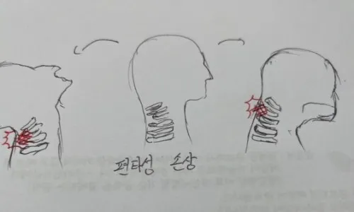 자동차 보험 약관 2024년 개정 변화  완산구 늘품애 한의원에서 알려드립니다.