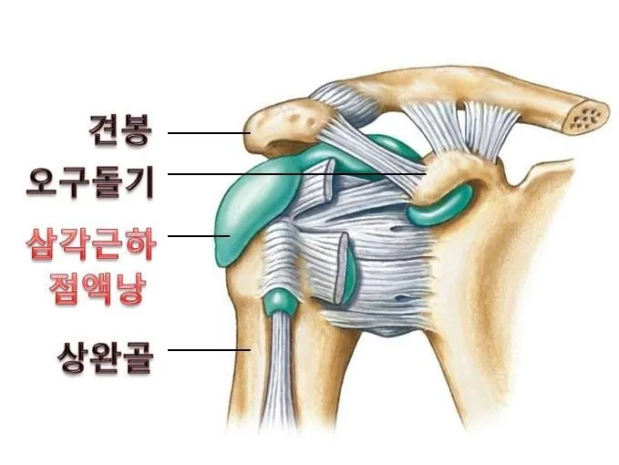 어깨 통증의 원인! 어깨 윤활낭염에 대해서 알아봅시다. (군산 명작한의원)