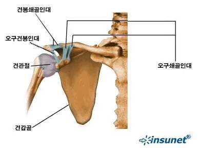 어깨가 밤에 아파요(견관절 관절염의 야간통. 군산 명작한의원)