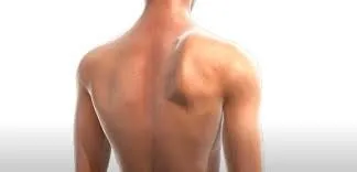 익상견갑(Wing Scapular)이란? 전거근과 장흉신경(Long Thoracic nerve)에 대해 (군산 명작한의원)