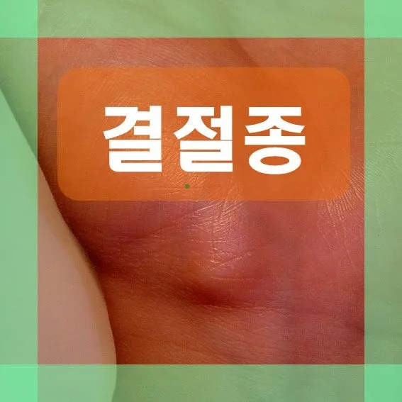 손목 결절종 관련하여 구월동 침 잘놓는 한의원에서 안내해드리는 내용