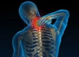 목이 아파요, 손이 저려요; 목디스크(Cervical disc herniation)