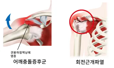 [어깨] 기초 스트레칭과 운동
