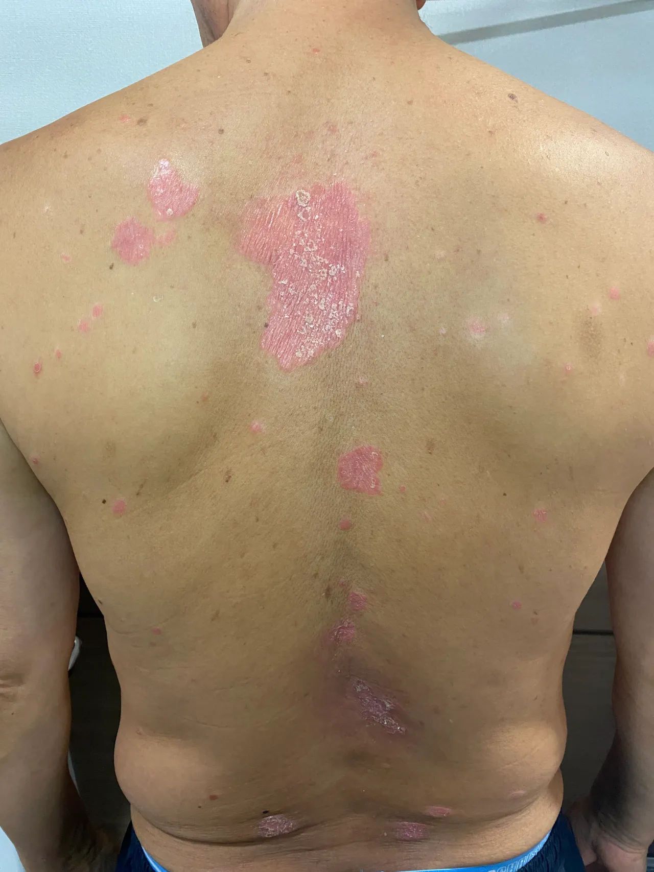 cover-skin-1.jpg
