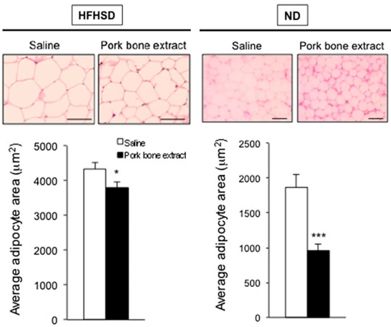 돼지 사골국의 고지방, 고탄수화물 식이(HFHSD) 및 정상식이(ND) 쥐에서 지방세포 크기 감소 효과